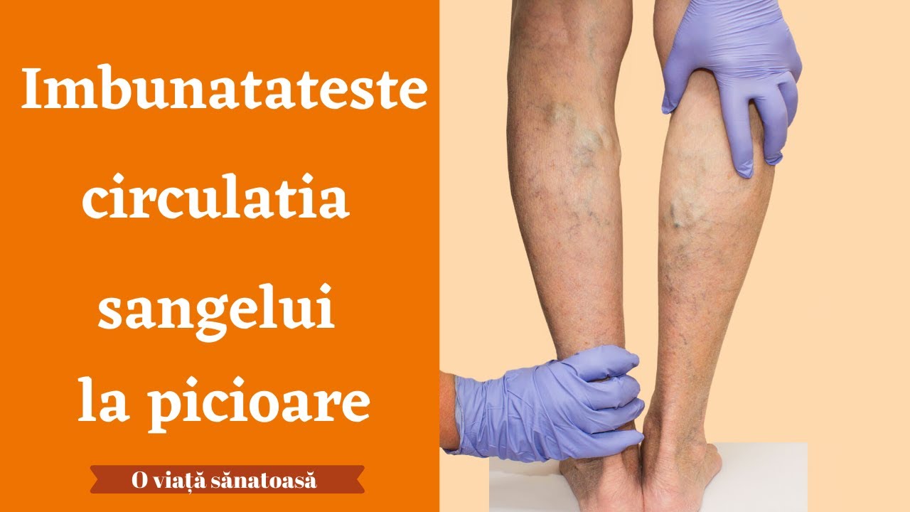 IMBUNATATESTE CIRCULATIA LA PICIOARE NATURAL