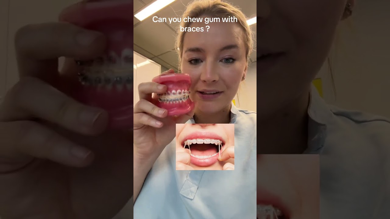 Chew gum with your braces! #braces