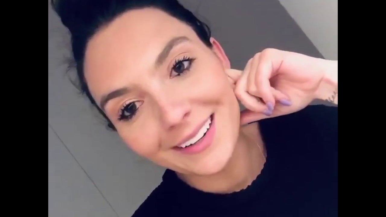 Gabrielle R Smile Transformation Featuring Porcelain Veneers | MyManhattanCosmeticDentist.com