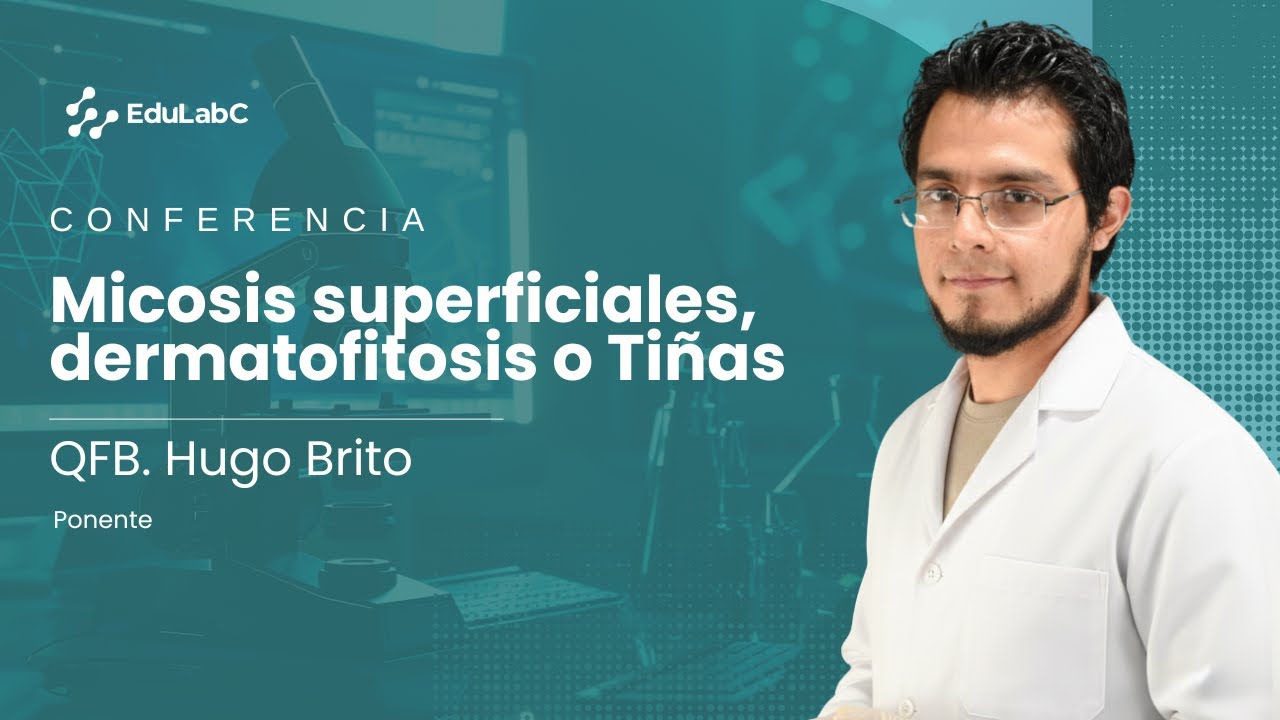 Micosis superficiales, dermatofitosis o Tiñas - QFB. Hugo Brito
