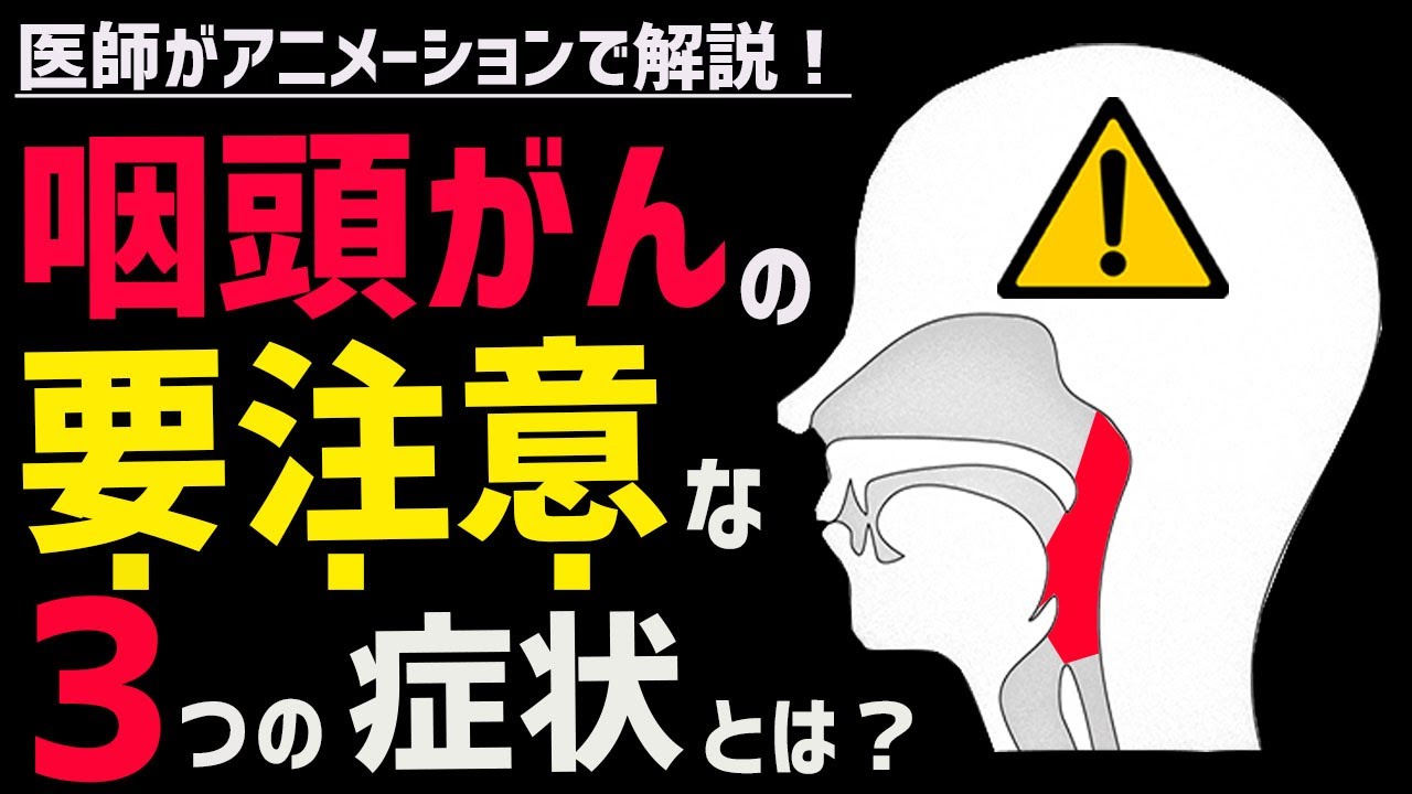 絶対に見逃してはいけない咽頭・喉頭がんの症状3選