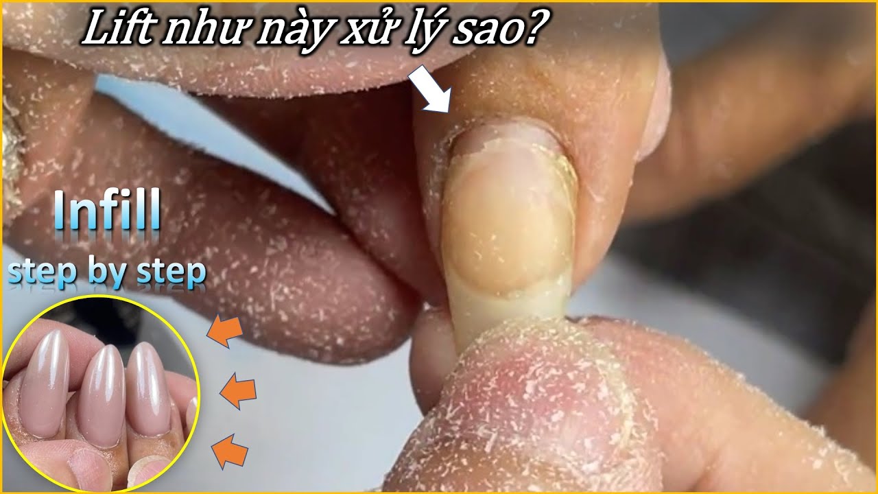 Cách xử lý Lift, phá bột, Đắp Fill móng vểnh || ThanhCong