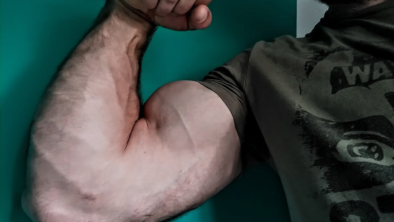 getting massive