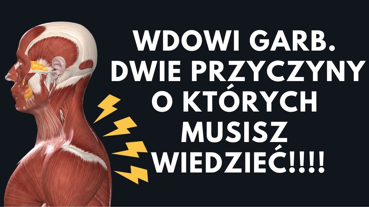 Wdowi garb. Jak się go pozbyć? Wszystko zależy KT&Oacute;REGO! Czy to wada postawy a może chodzi o HORMONY?