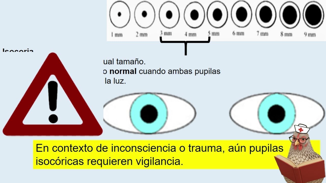 Valoración Pupilar en Enfermería | Guía Rápida y Fácil