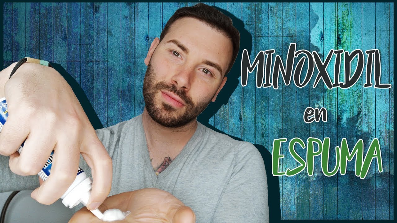 PROBANDO el MINOXIDIL en ESPUMA