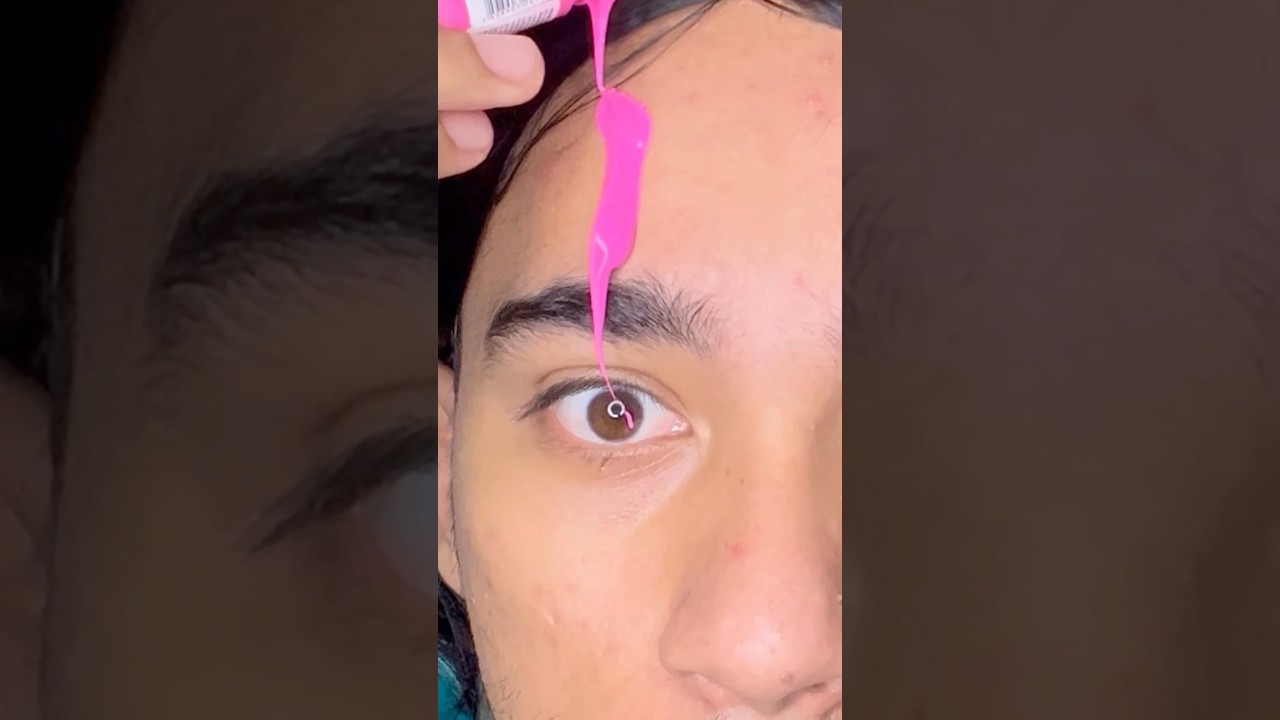 O DIA QUE MEU OLHO FICOU ROSA KAKAKAKSSKSK