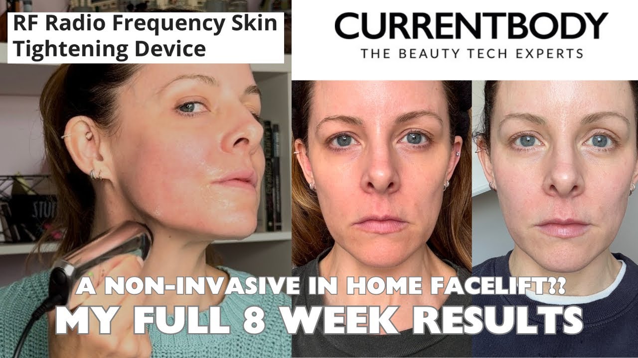 MY RESULTS! 8 WEEK UPDATE - Full test of Current Body RF Radio Frequency Device - At home facelift?