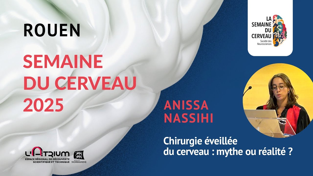 Anissa Nassihi - Chirurgie éveillée du cerveau : mythe ou réalité ?