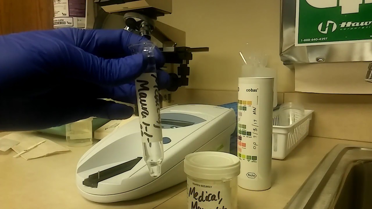 Roche Urisys 1100: Οδηγός χρήσης