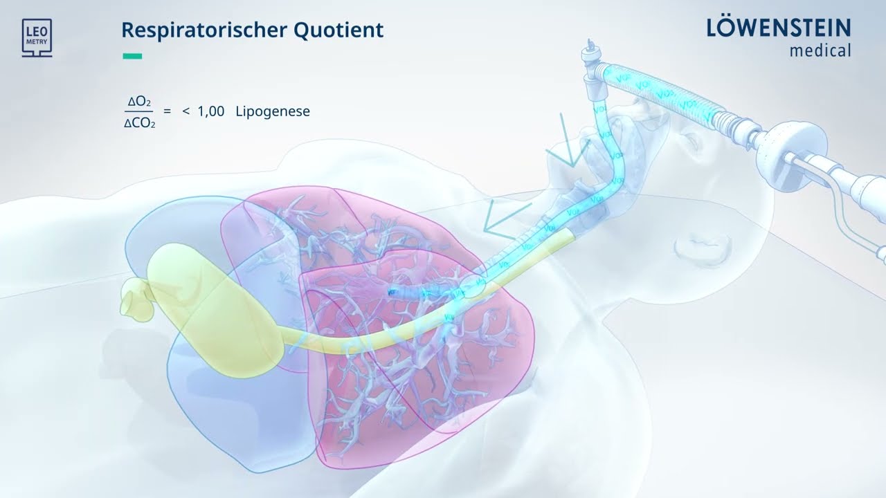 LEOMETRY &ndash; der Goldstandard f&uuml;r das barrierefreie Ern&auml;hrungsmonitoring bei Beatmungspatienten.