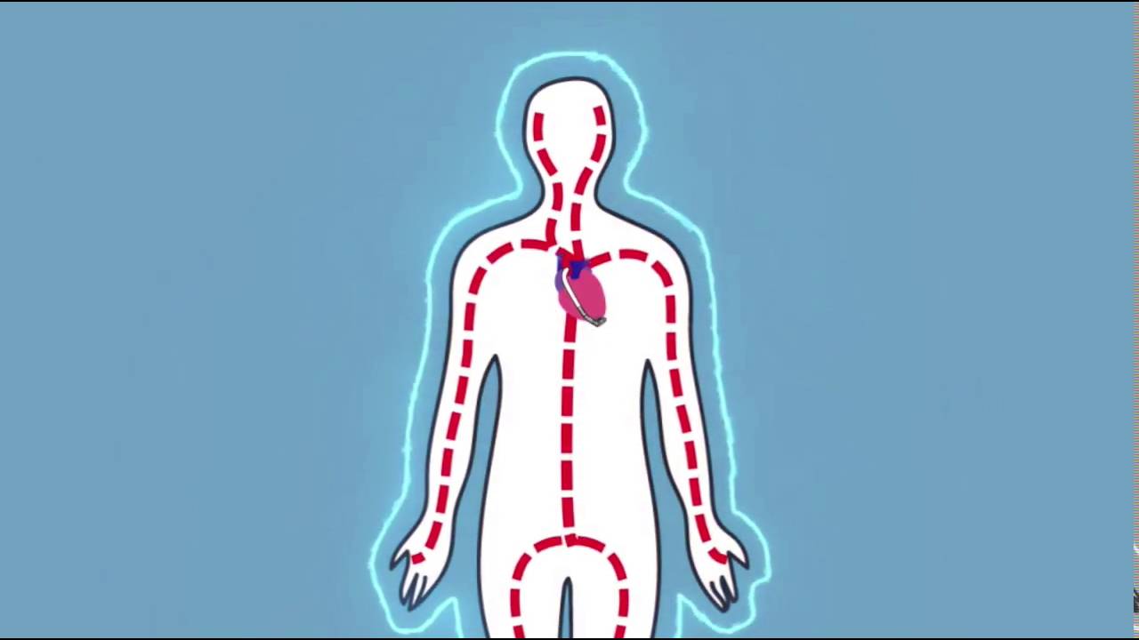 Advanced Heart Failure and the HVAD