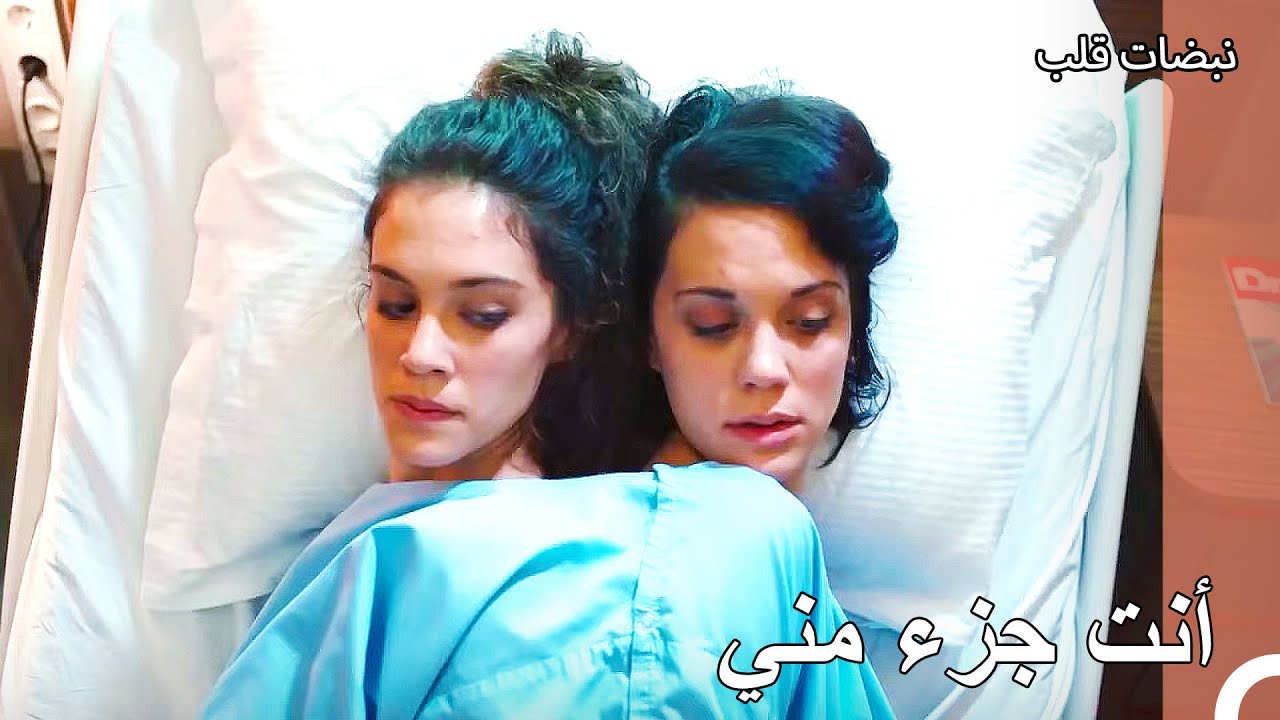 التوأم الملتصق في المشفى - نبضات قلب