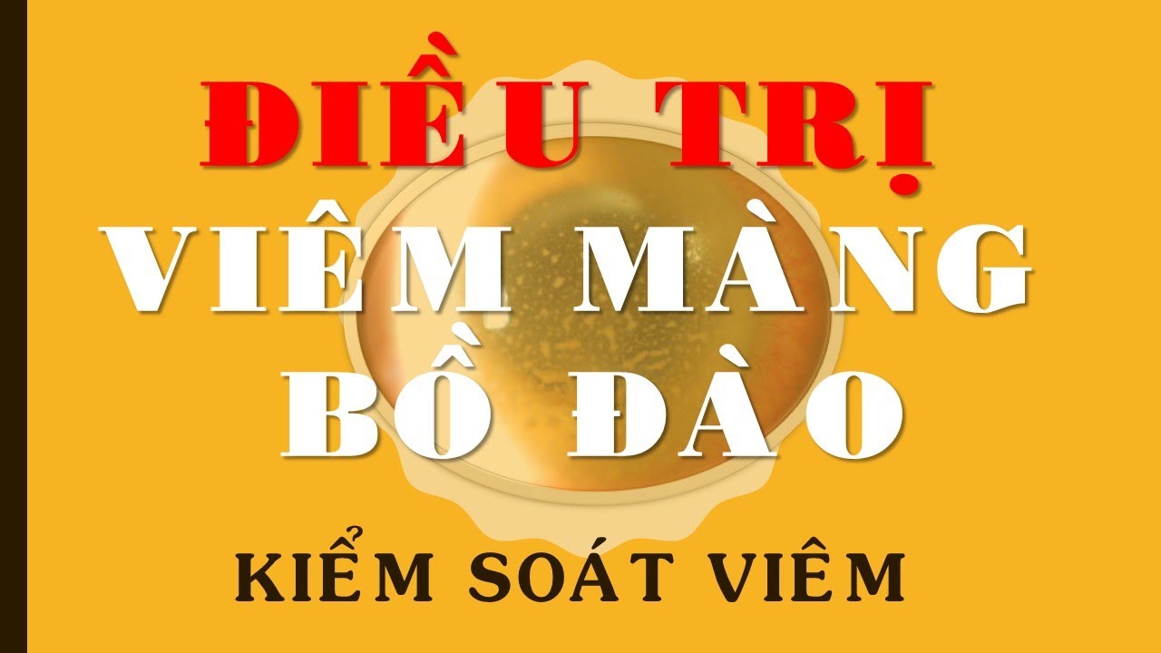 VLOG #72: Điều trị viêm màng bồ đào thế nào?
