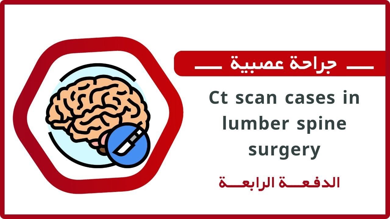 مقاربة حالات سريرية على الطبقي || د. أنس بيطار