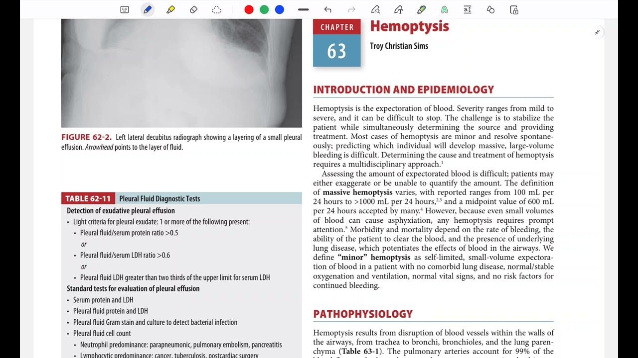 Hemoptysis 