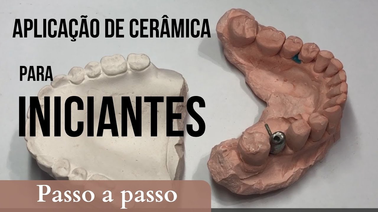 Aplicação de porcelana sobre implante para INICIANTES