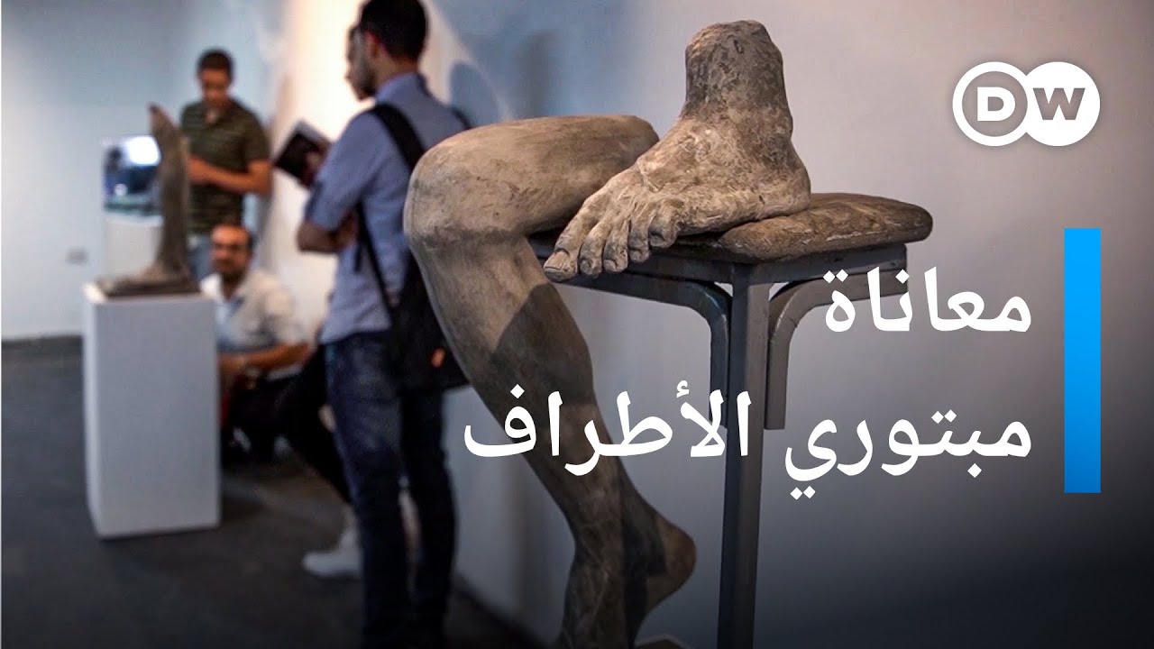 معرض يعكس معاناة مبتوري الأطراف | في عين الكان