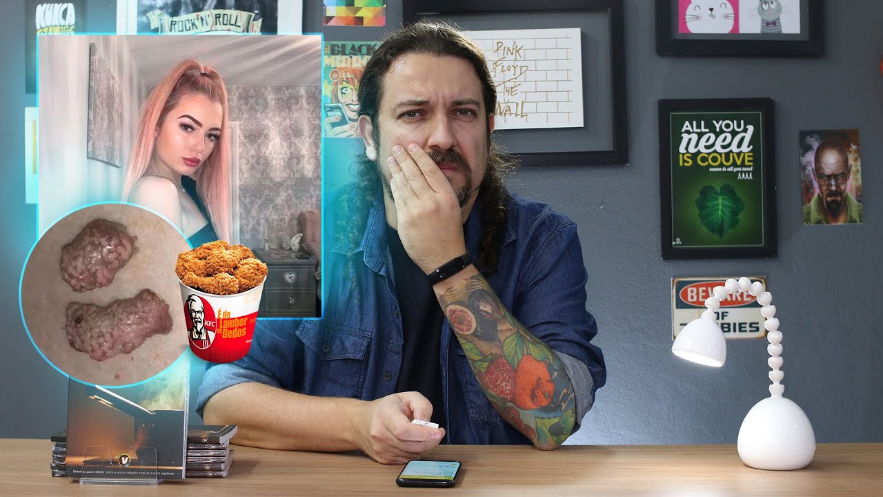 Garota pede frango no KFC e recebe pedaços de cérebro