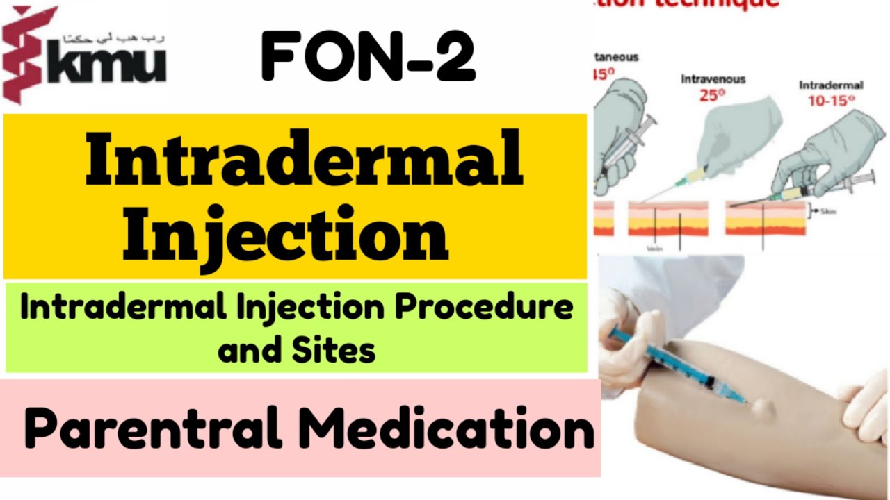 Intradermal Injection in Urdu/Hindi | Parenteral Medication FON 2 | Intradermal Injection Procedure.