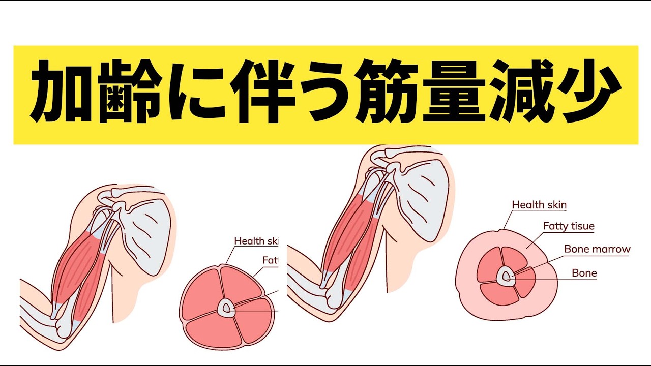 筋肉量が長寿の鍵である理由