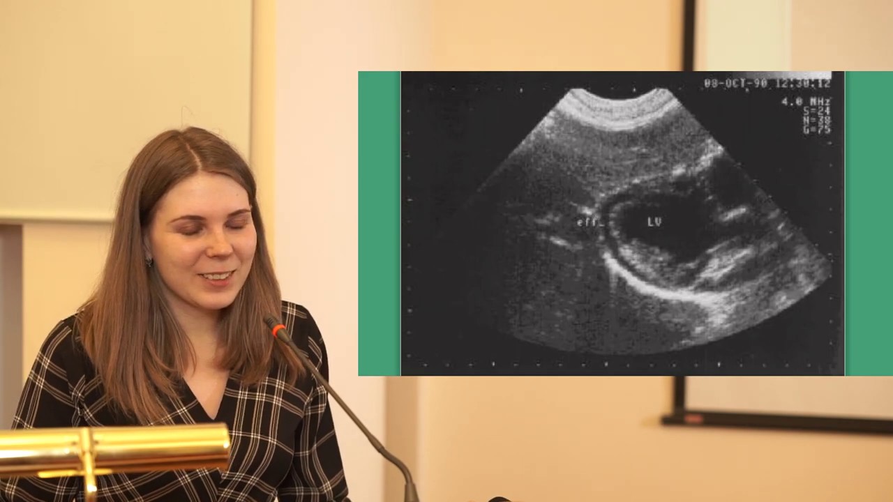 Амиодарон индуцированные заболевания щитовидной железы часть 1