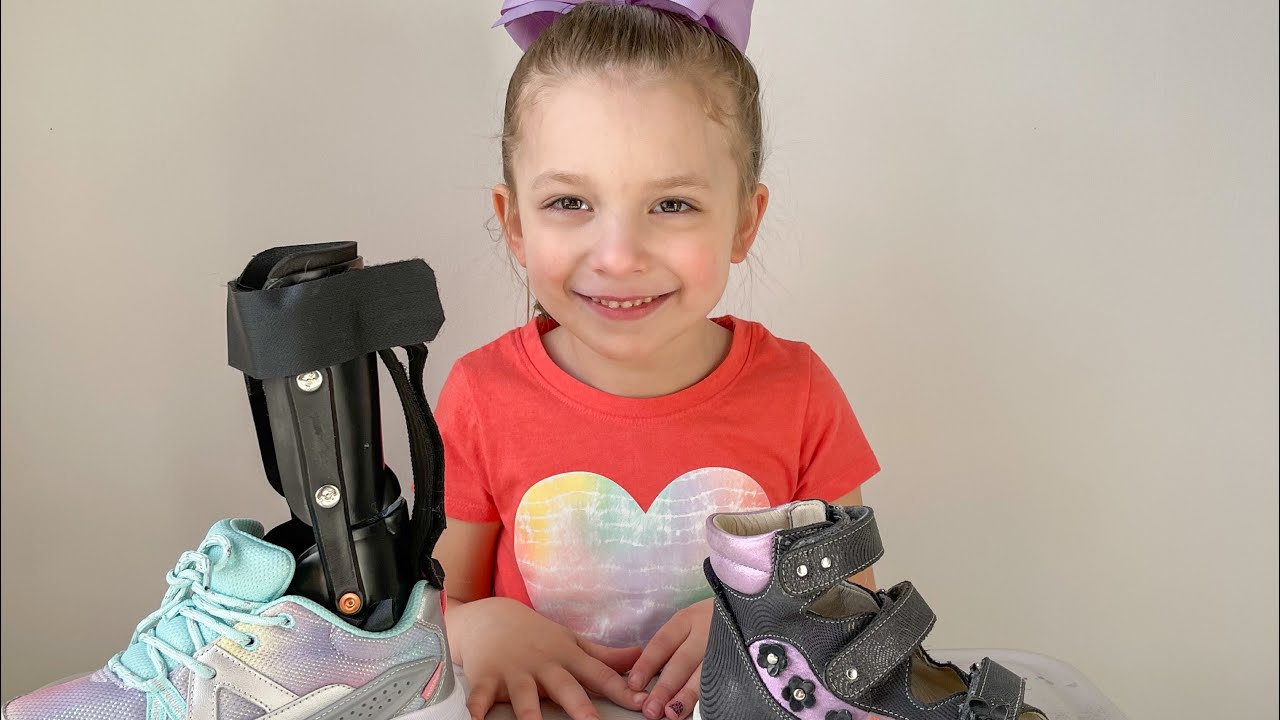 CEREBRAL PALSY & AFO’s ANKLE FOOT ORTHOTICS! When to wear AFO’s and Memo Orthopedic Shoes.