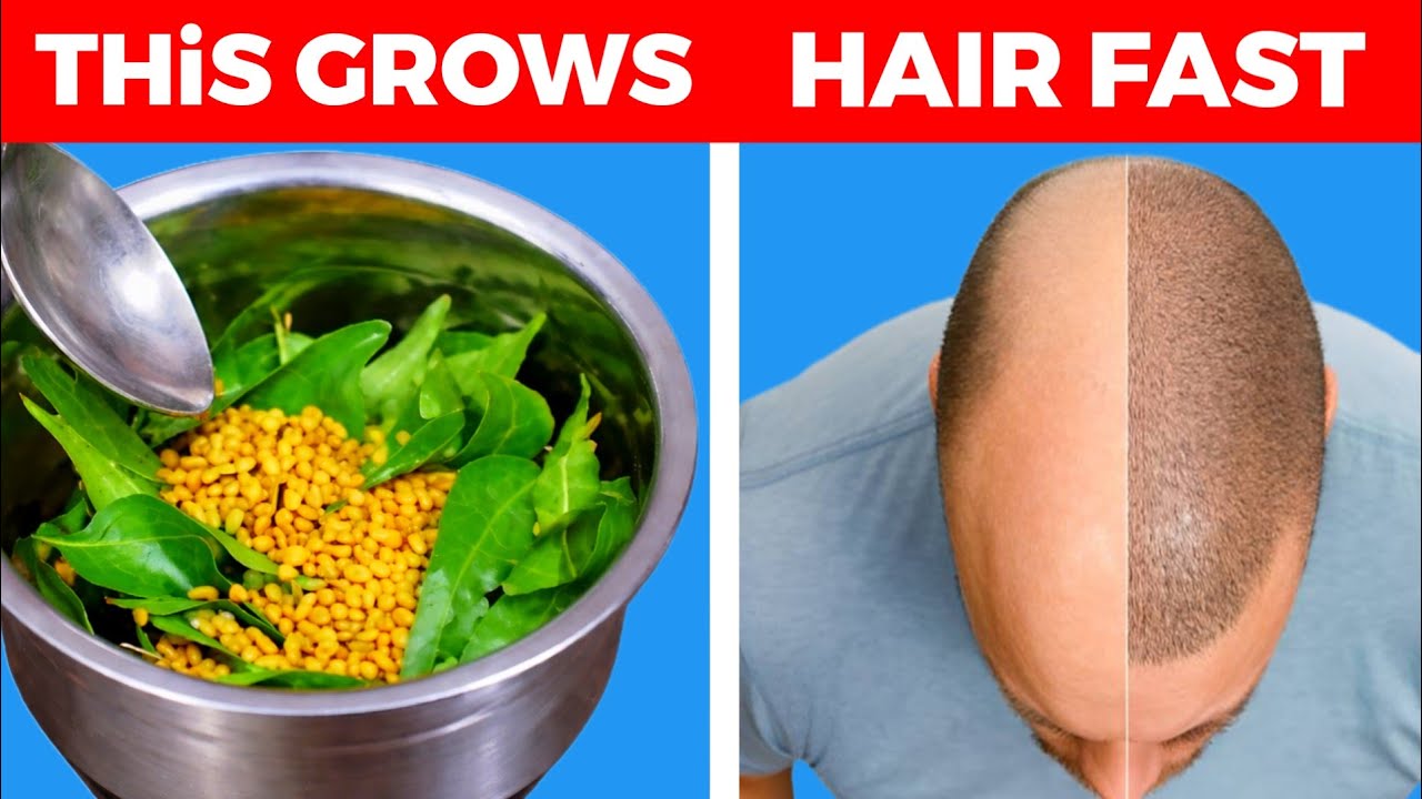 This Simple Homemade Remedy Grows Hair Fast | Stop Hair Fall Naturally