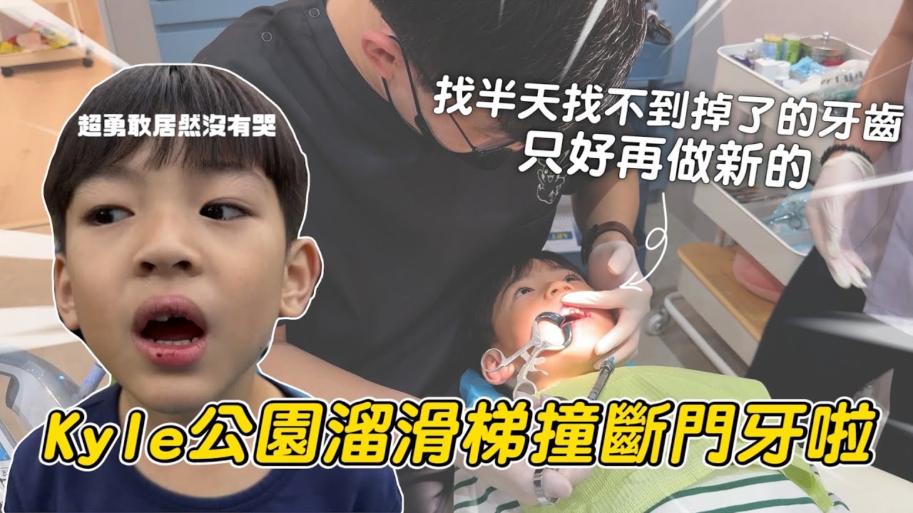 緊急狀況！Kyle公園玩耍居然把門牙給撞斷了｜彼得爸與蘇珊媽