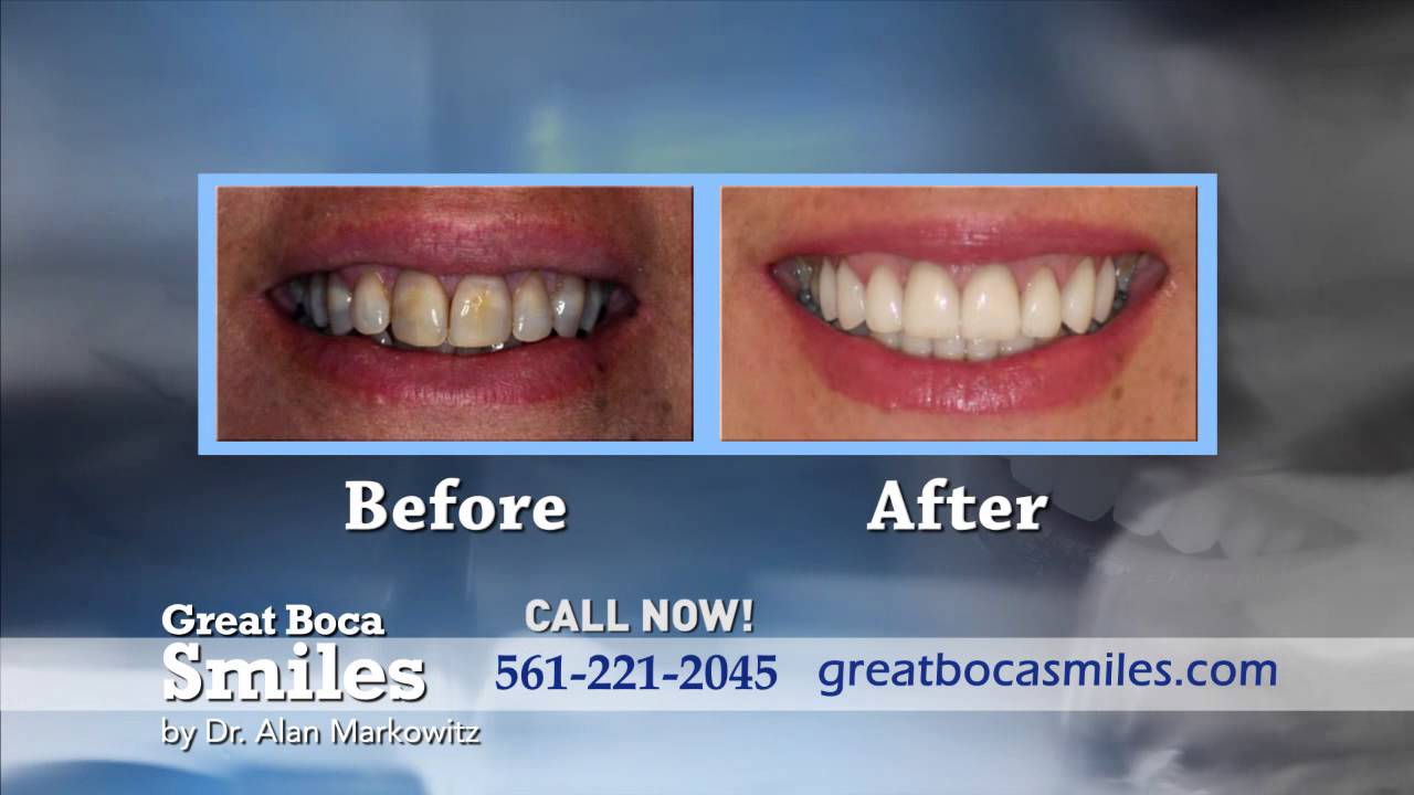 Boca Raton's Best Dentist: Dr. Alan Markowitz of Great Boca Smiles