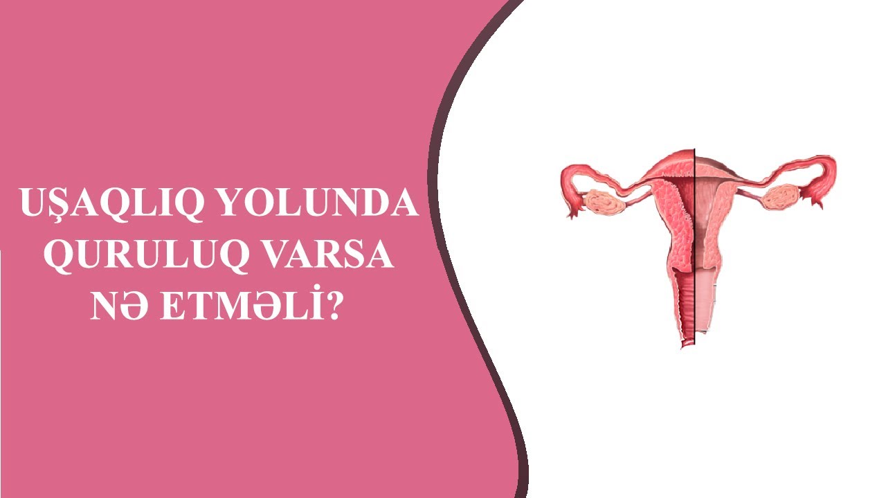 UŞAQLIQ YOLUNDA QURULUQ VARSA, NƏ ETMƏLİ?
