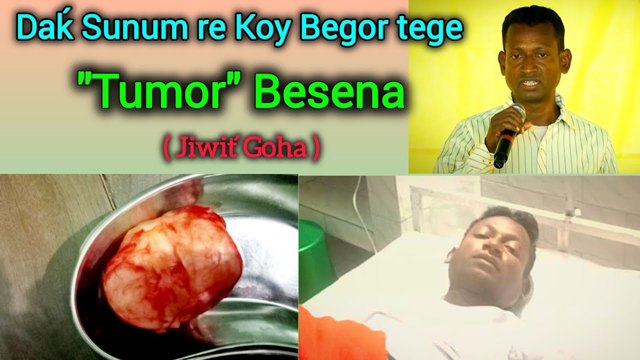 Daḱ Sunum re Koy Begor tege | 