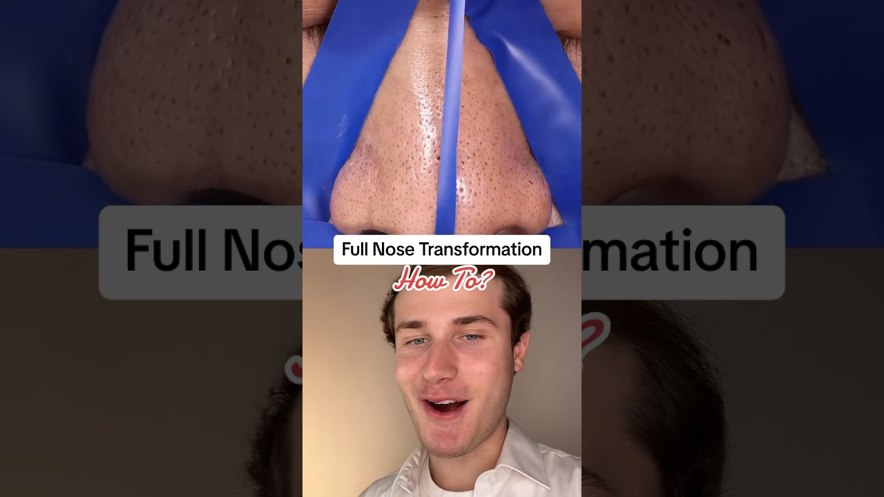 Чёрные точки на носу? В ЭТОМ ли секрет шорт?