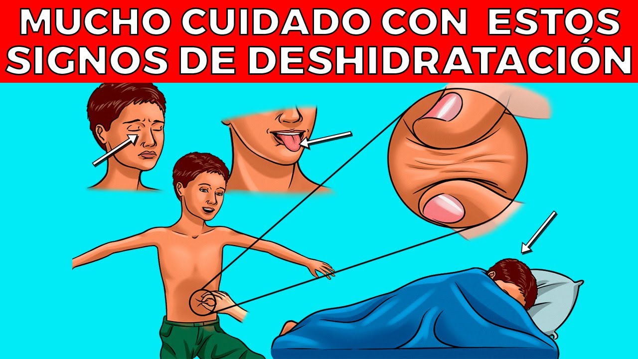 6 señales de DESHIDRATACIÓN SEVERA, causas y que hacer