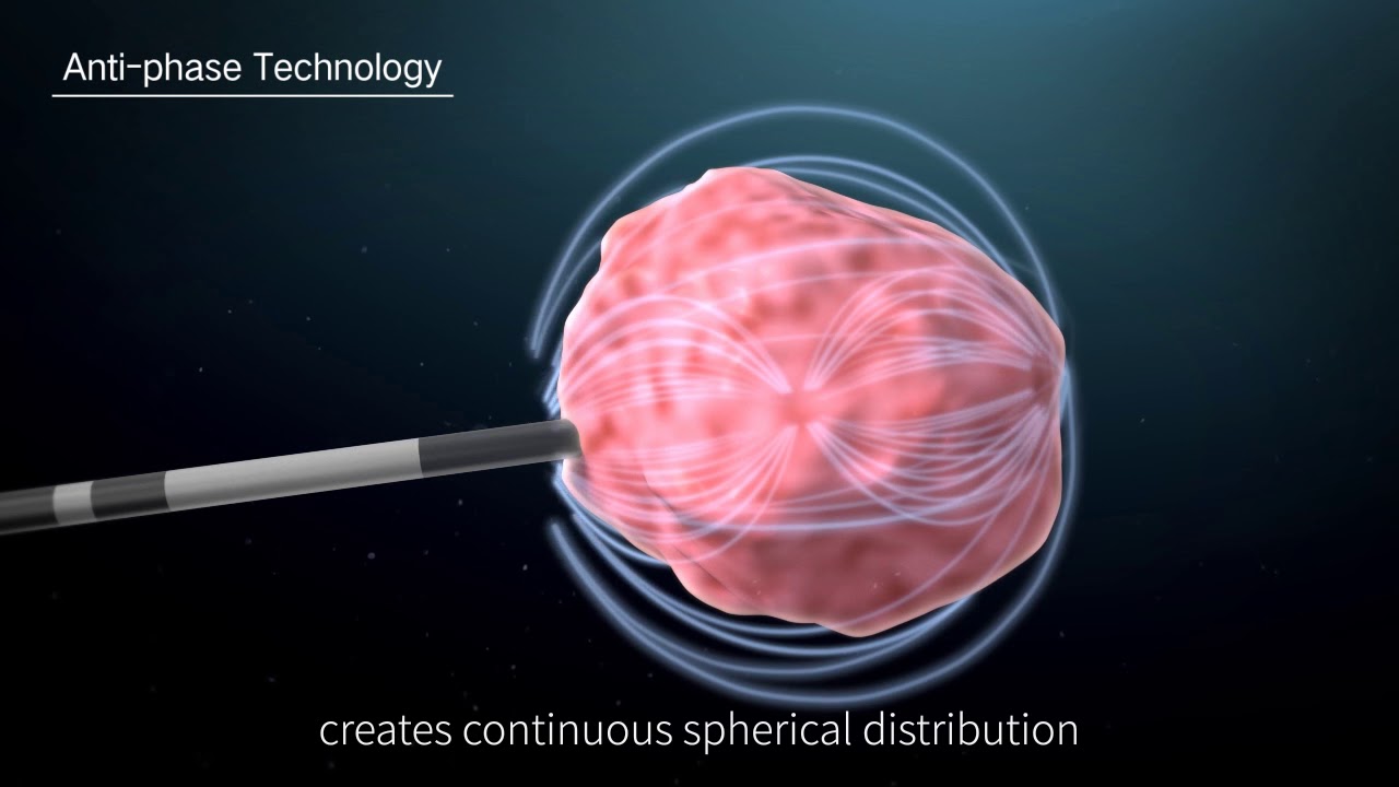 Surgnova Dophi&trade; M150E Microwave Ablation System