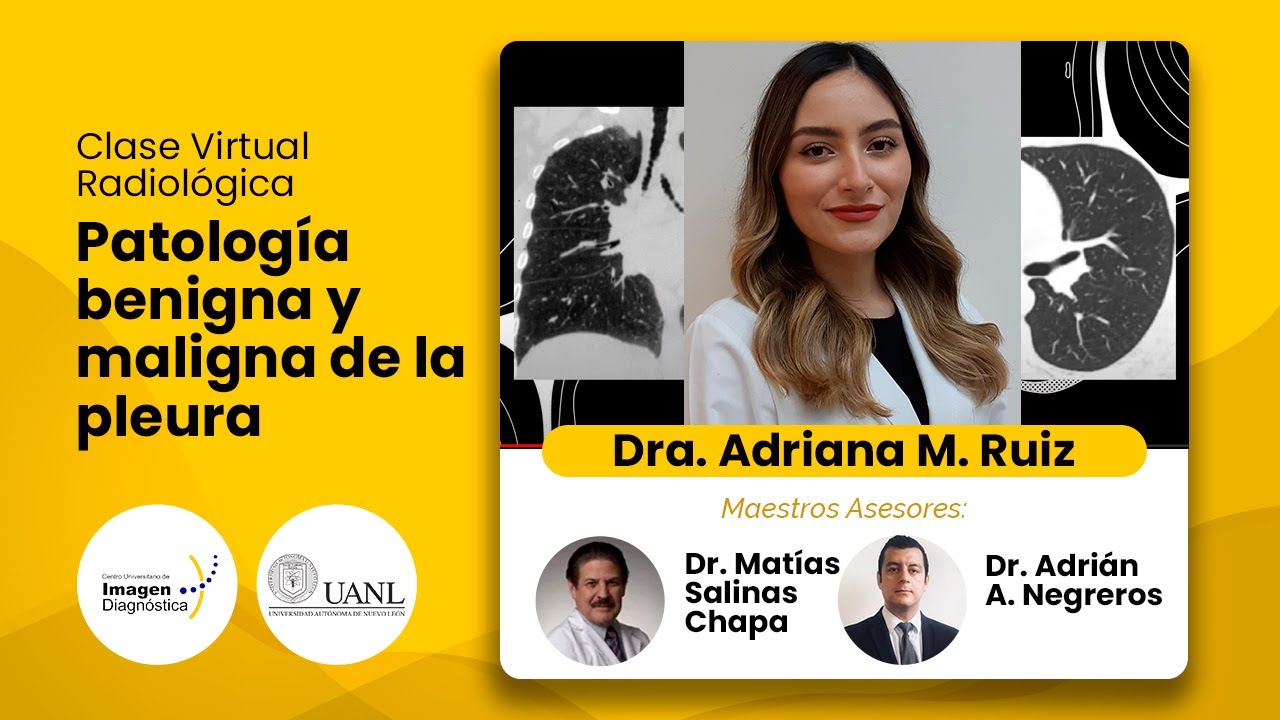 Patología benigna y maligna de la pleura. Dra. Adriana M. Ruiz Delgado