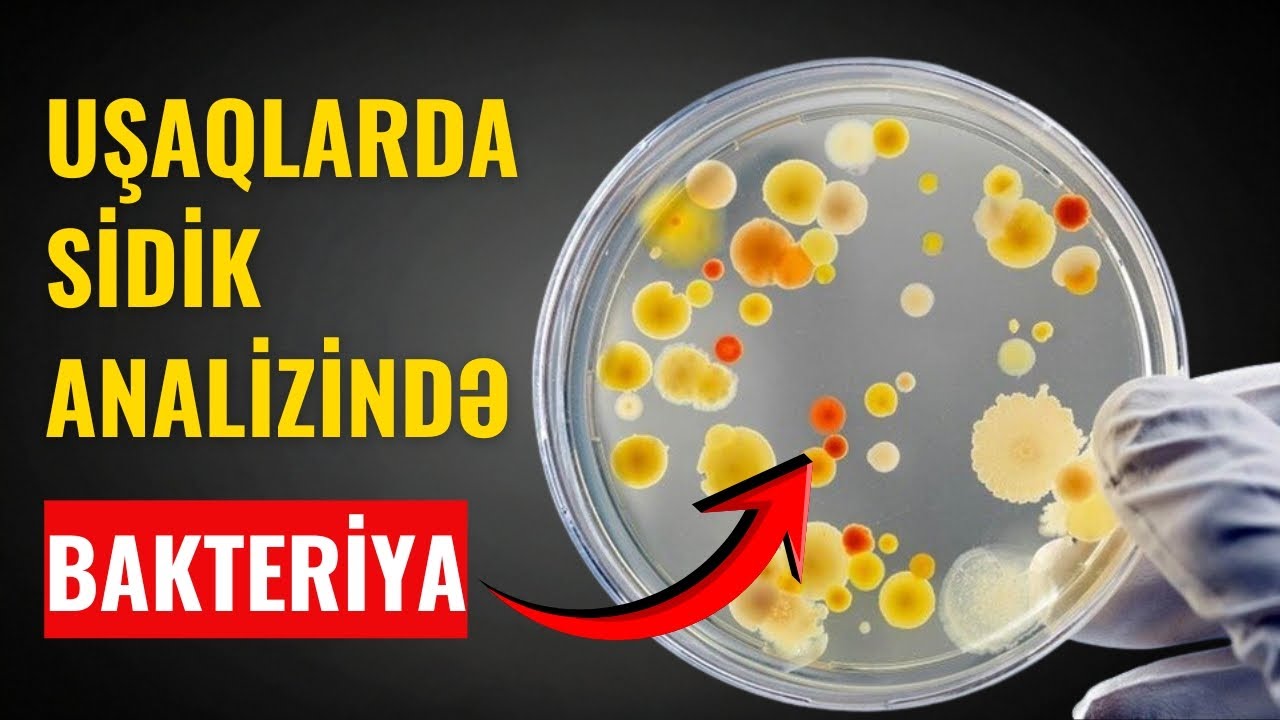 Sidik analizində bakteriya çıxıbsa, nə etməli?