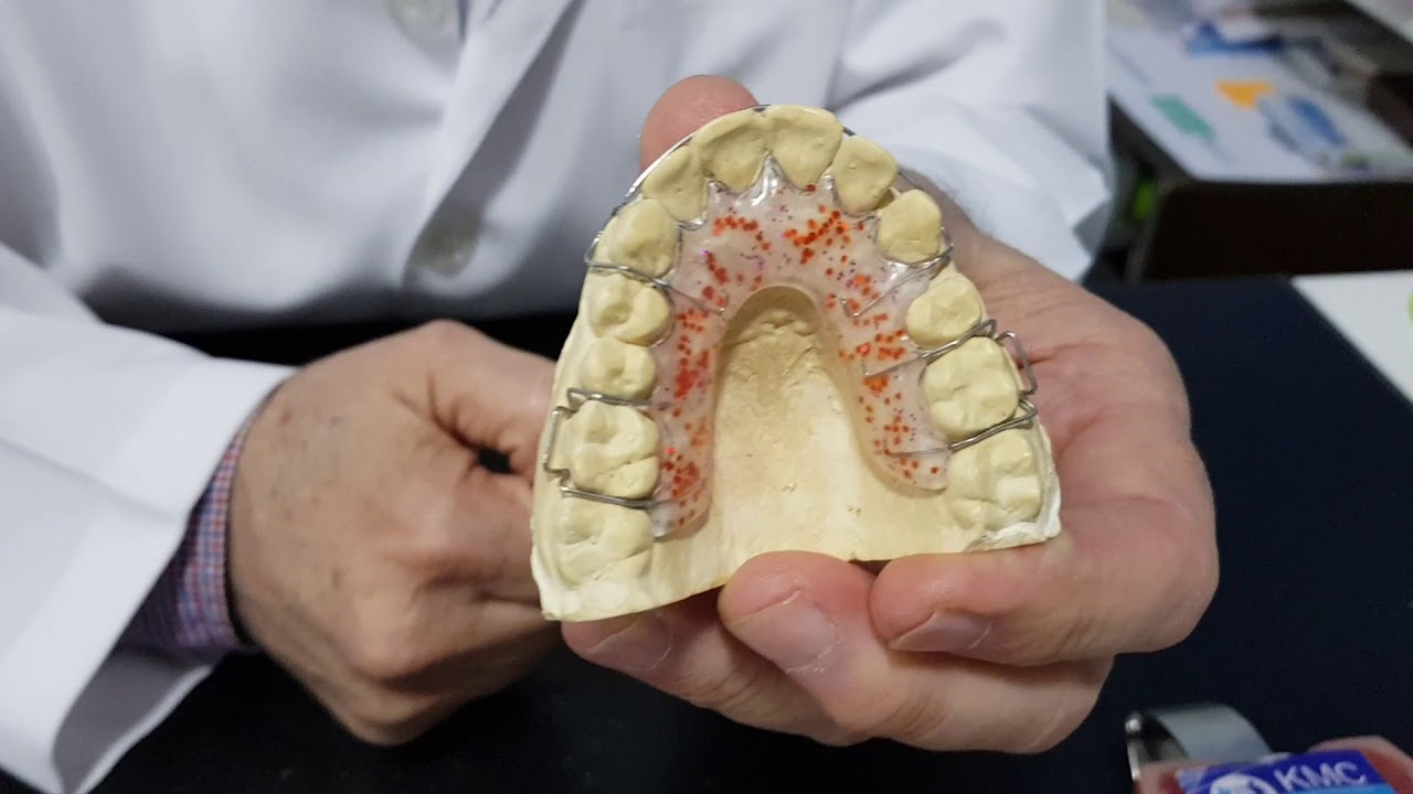 مواصفات جهاز التثبيت المتحرك  بعد التقويم Removable Ortho.  Retainer