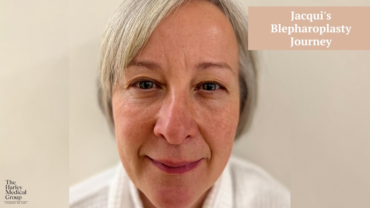 Jacqui's Blepharoplasty Journey Part 1 | The Harley Medical Group