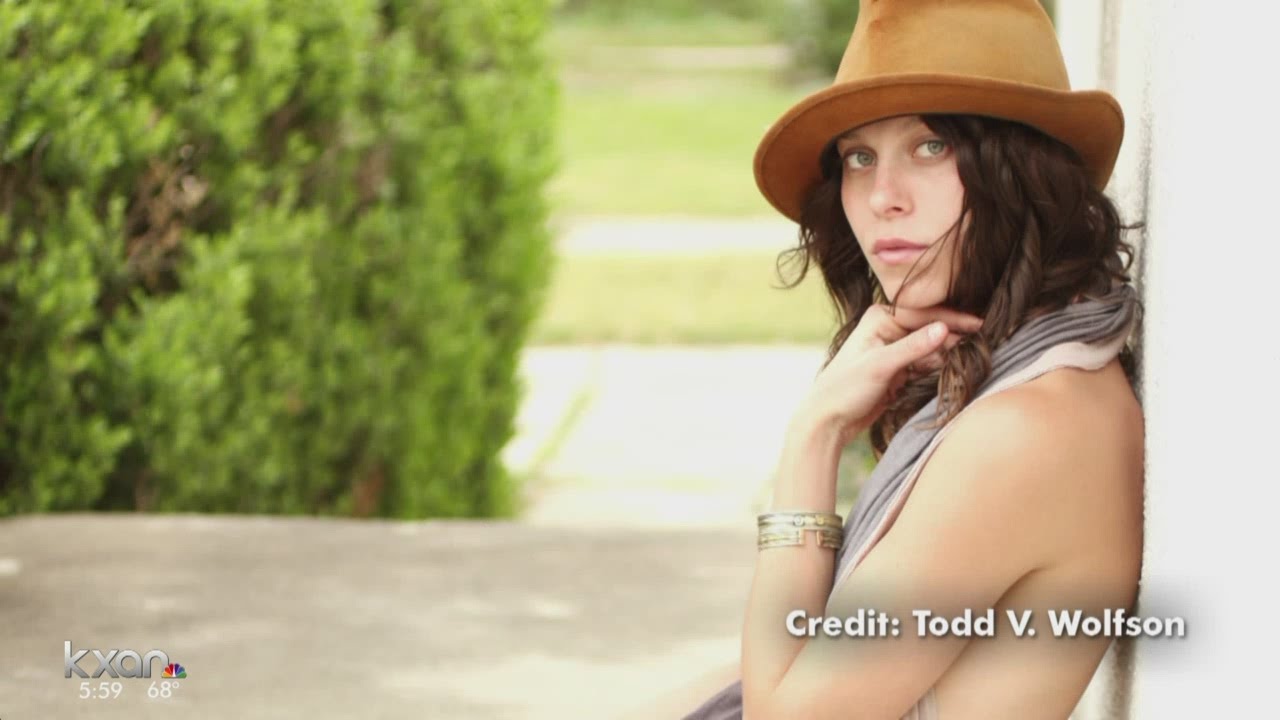 Singer loses leg after Wimberley Farmers Market crash