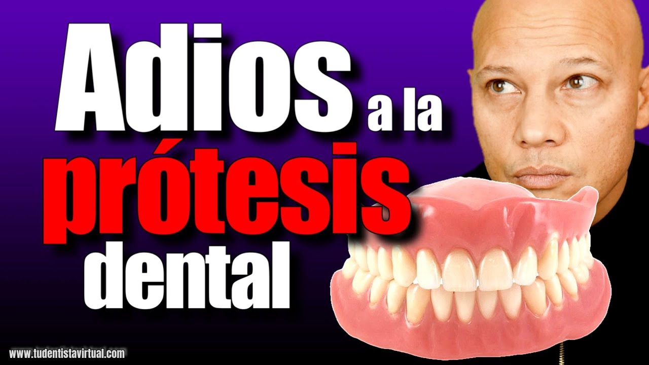 LA MEJOR FORMA de REEMPLAZAR TU PROTESIS DENTAL sin TENER MUCHO HUESO en las ENCÍAS