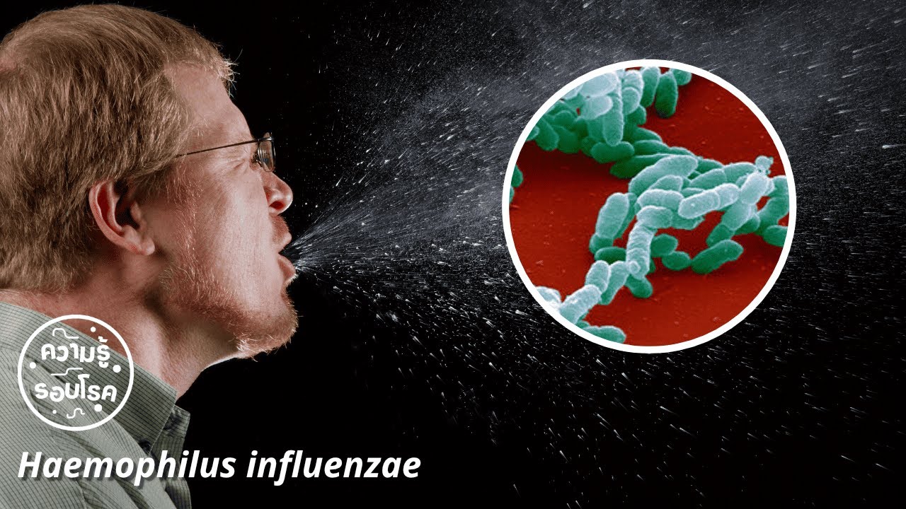 "Haemophilus influenzae" เชื้อแบคทีเรียคล้ายไข้หวัด !!! | ความรู้รอบโรค