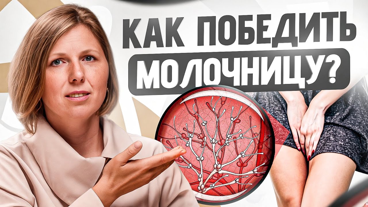 Молочницу нужно лечить НЕ ТАК, как вы это делаете! 4 секрета от врача гинеколога