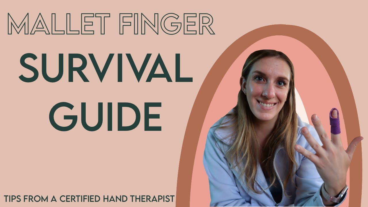 How to survive a mallet finger injury! 5 tips from a Certified Hand Therapist...