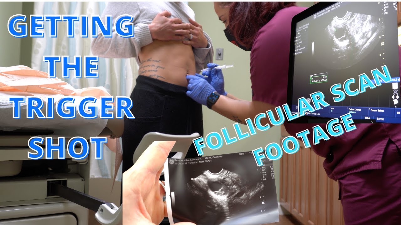 GETTING THE HCG TRIGGER SHOT//FOLLICULAR ULTRASOUND FOOTAGE//CD13//TTC BABY NUMBER 2