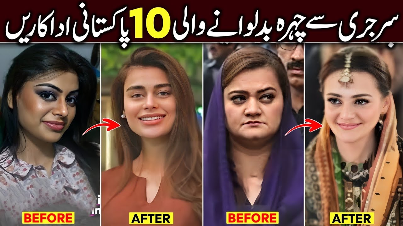 Pakistani Celebrities who Changed their Faces with Money and Became Beautiful