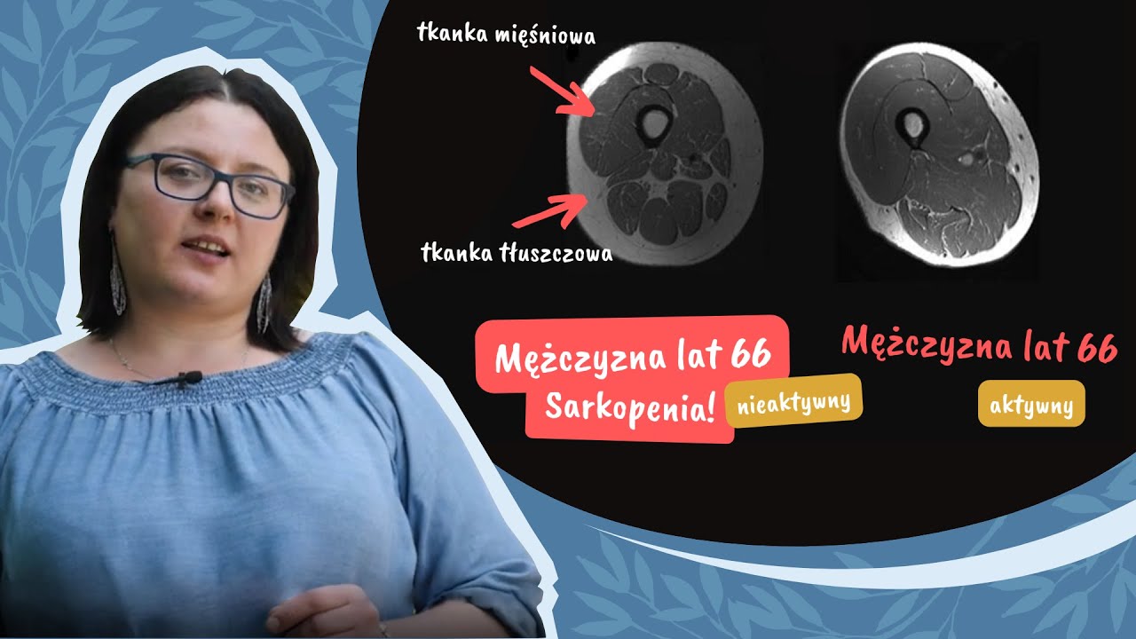 Sarkopenia, czyli 