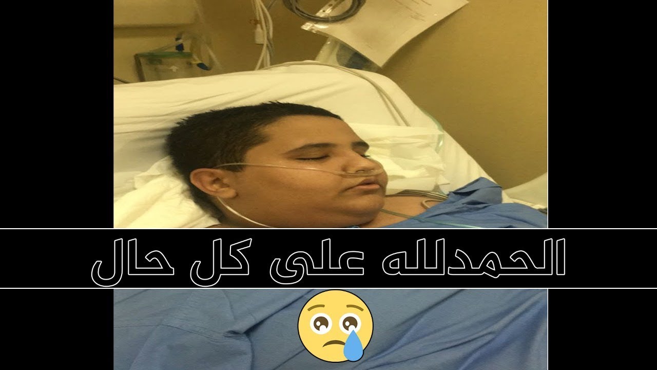 قصة التكميم؟٠