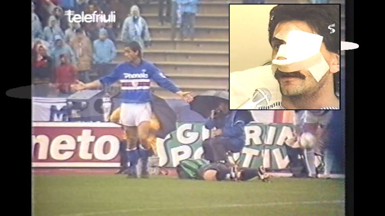 UDINESE-SAMPDORIA 0-0 SERIE A 1986-87 IL CT ROBERTO MANCINI ROMPE IL SETTO NASALE A FABIO BRINI.