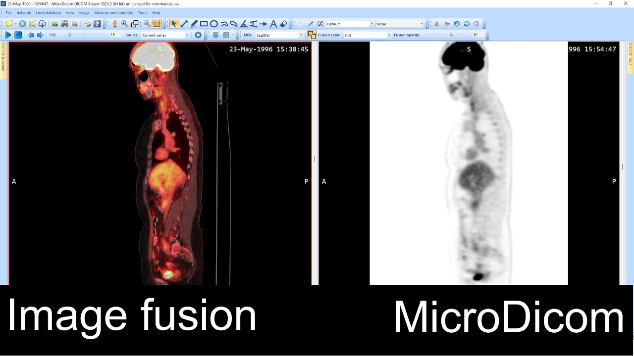 Image fusion in MicroDicom DICOM Viewer